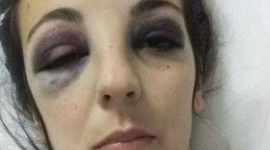 mujer golpeada ticino expareja jugador futbol