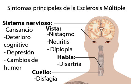sintomas esclerosis multiples